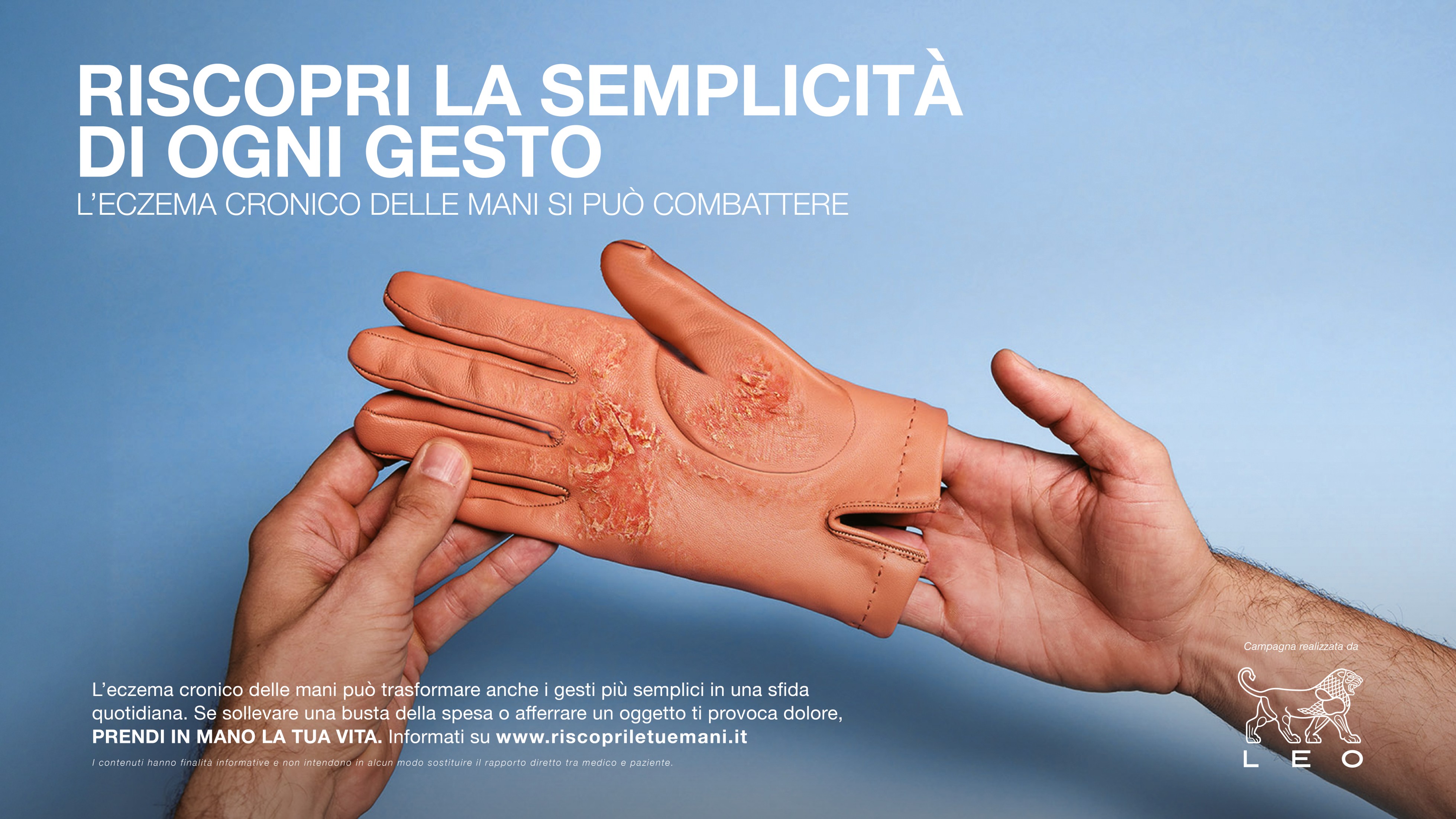 Immagine di 'Prendi in mano la tua vita. Una campagna di disease awareness che racconta l’eczema cronico delle mani a partire dai gesti della vita quotidiana.'